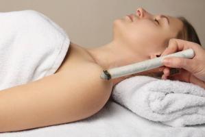 Moxibustion principale 1